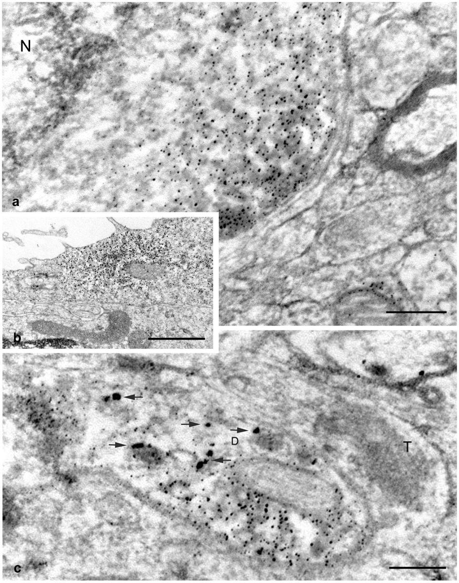 Belenky et al. Page 25 Fig. 7. Electron micrographs showing distribution of NKCC1in the SCN.