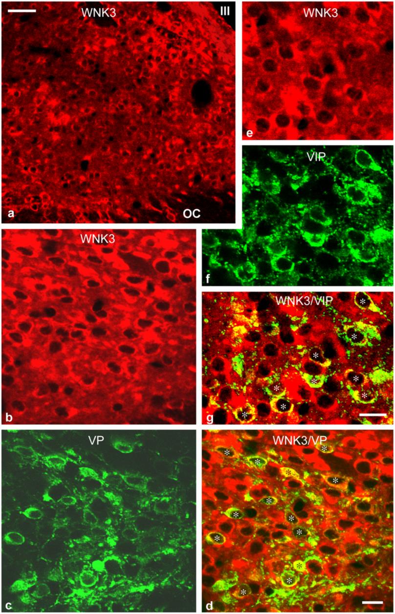 Belenky et al. Page 26 Fig. 8. Confocal images illustrating the distribution of WNK3, a serine-threonine kinase, in the SCN of a rat subjected to colchicine treatment.