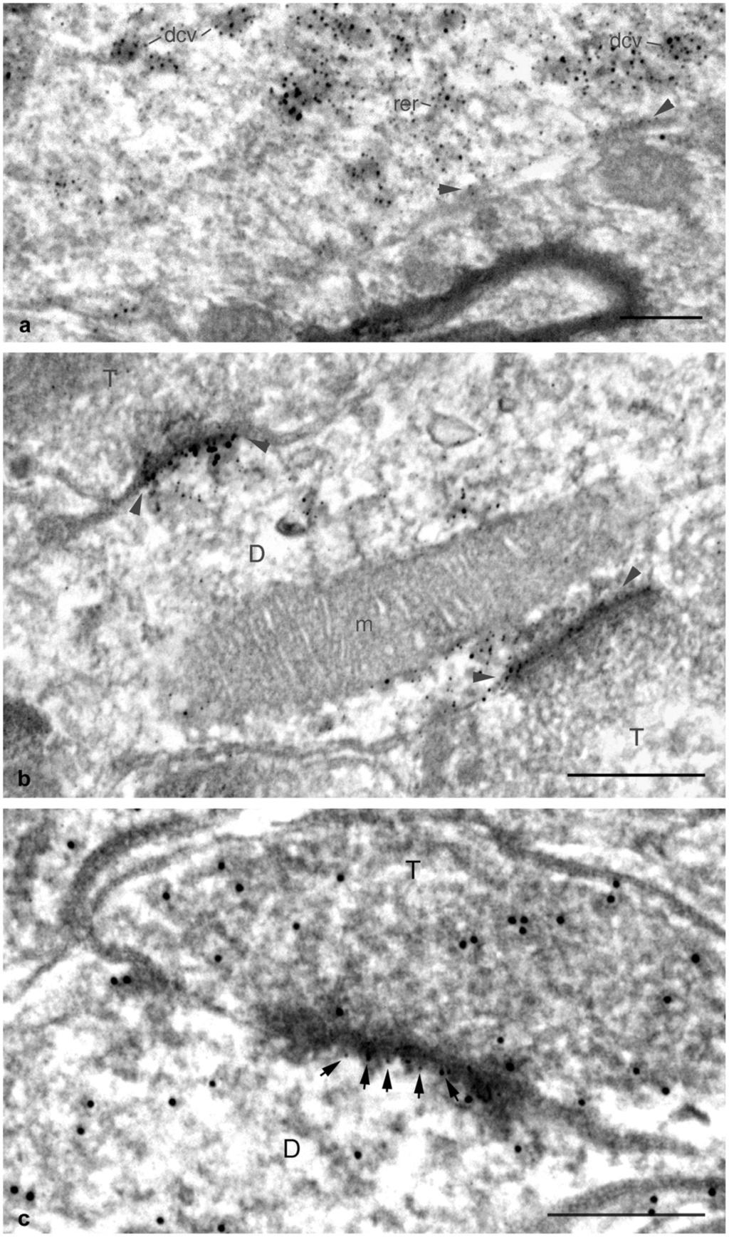 Belenky et al. Page 27 Fig. 9. Electron micrographs demonstrating sub-cellular distribution of WNK3 kinase in SCN neurons.