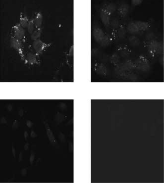 Immunofluorescence staining performed with an antibody against amino acid residues 45 54 of human metastin showed lower labeling in T47D than in MDA- MB-231 cells, and no labeling in MDA-MB-435 cells