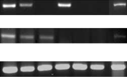 Semiquantitative PCR products were analyzed by 3% low-melting agarose gel electrophoresis. B.
