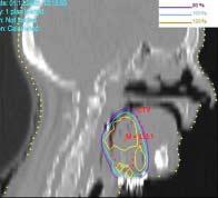 dosimetry on CT images 63 Figure 3: 2D and