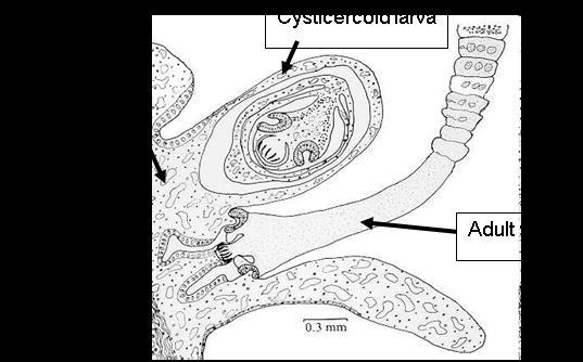 human); cysticercoids (in mucous membrane villi of the intermediate host