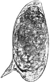 Male, female and egg of Schistosoma mansoni Male, female and eggs of Schistosoma japonicum