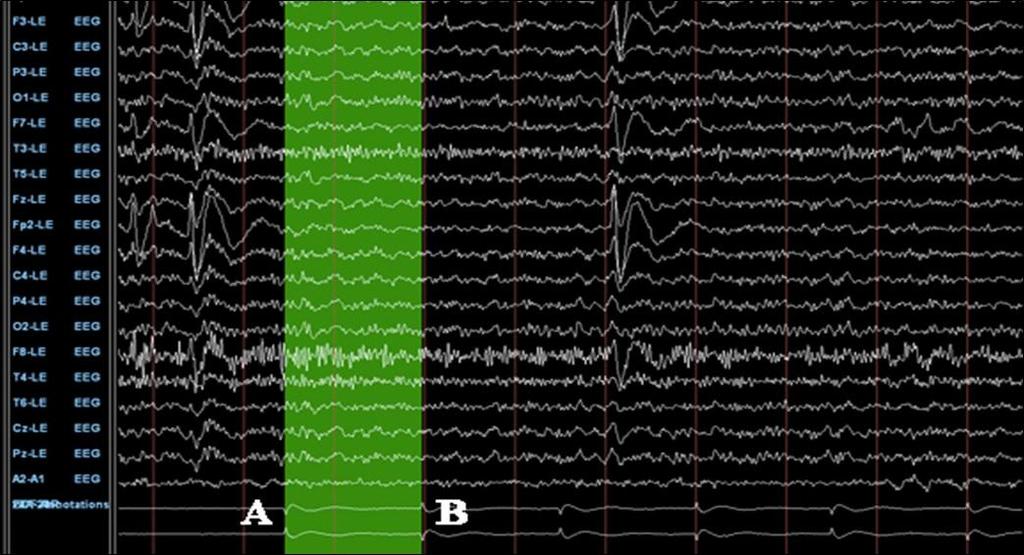 Event-Related EEG Imaging (c)