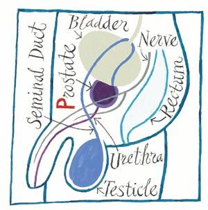 Prostate Cancer Prostate is surrounded by the bladder, rectum, and urethra.