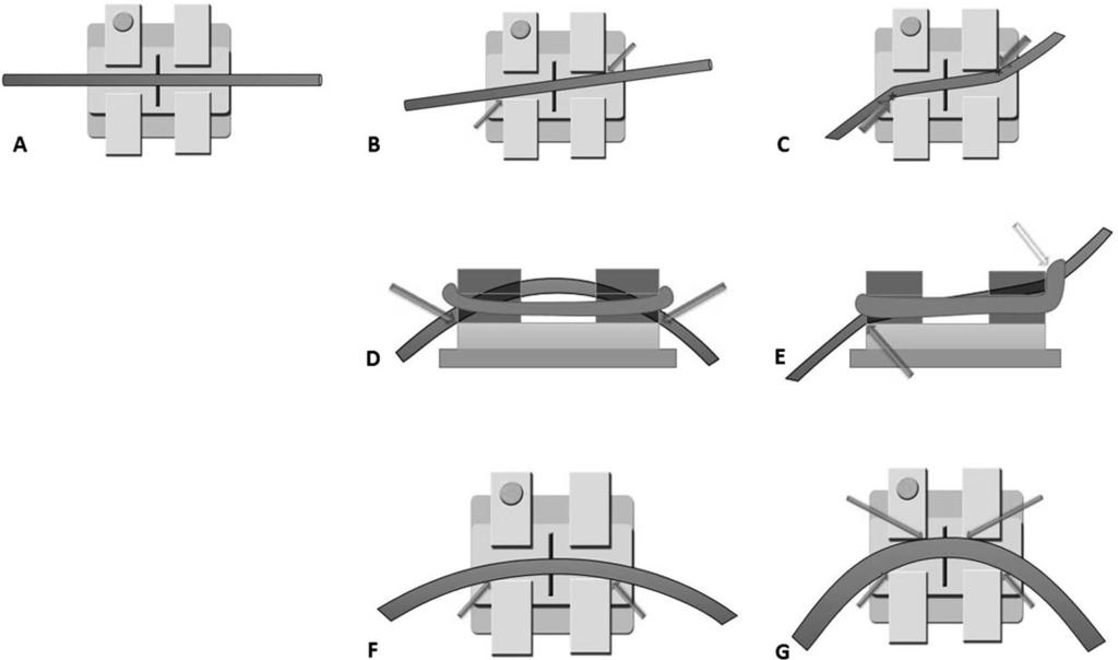 6 GIBSON, LIN, PHILLIPS, EDELMAN, KO Figure 5. (A) Diagrammatic representation of classical friction orientation in tipping.