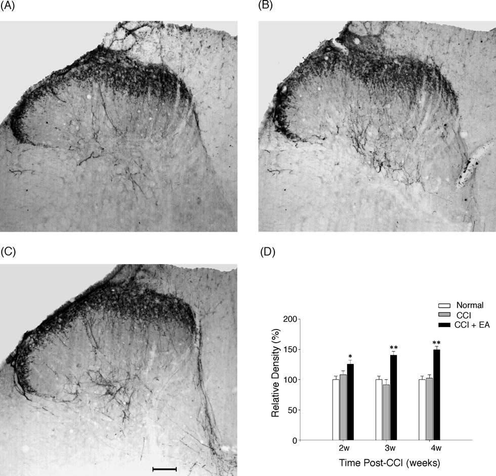 192 Z.-Q. Dong et al. / Neuroscience Letters 385 (2005) 189 194 Fig. 2. Effect of EA on the expression of SOM in ipsilateral spinal dorsal horn in neuropathic pain rats.
