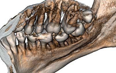 IMPLANTS TMJ CB3D is one of the most effective tools available for analyzing implant sites.