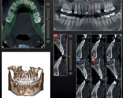 3D image reconstruction can clearly provide detailed information of the TMJ and Cervical Spine