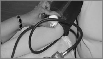 Blood Pressure Measurement Bell of stethoscope is lightly placed on the skin