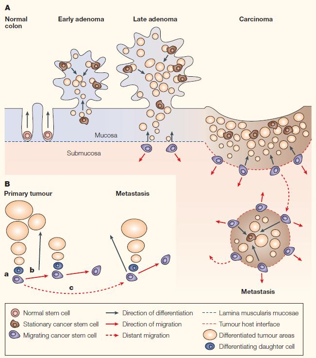 Figure 2.2. Colon cancer progression and MCS cells.