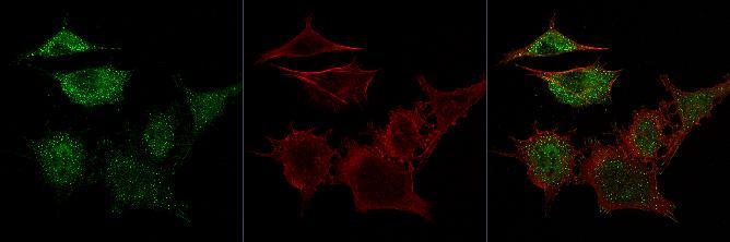 Cells treated with ZOL showed reductions in F-actin