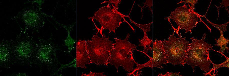 showed reductions in F-actin and focal adhesions.