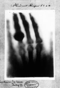 X-rays were discovered in 1895 by Wilhelm Conrad Röntgen (1845-1923) who was a Professor at Wuerzburg University in Germany.