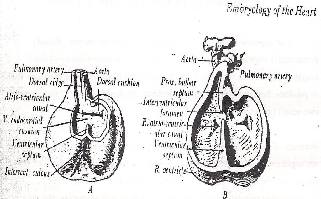 Review of Literature Fig (1): Formation of endocardial cushions and mitral and tricuspid valve (Bharati and Lev, 2006).