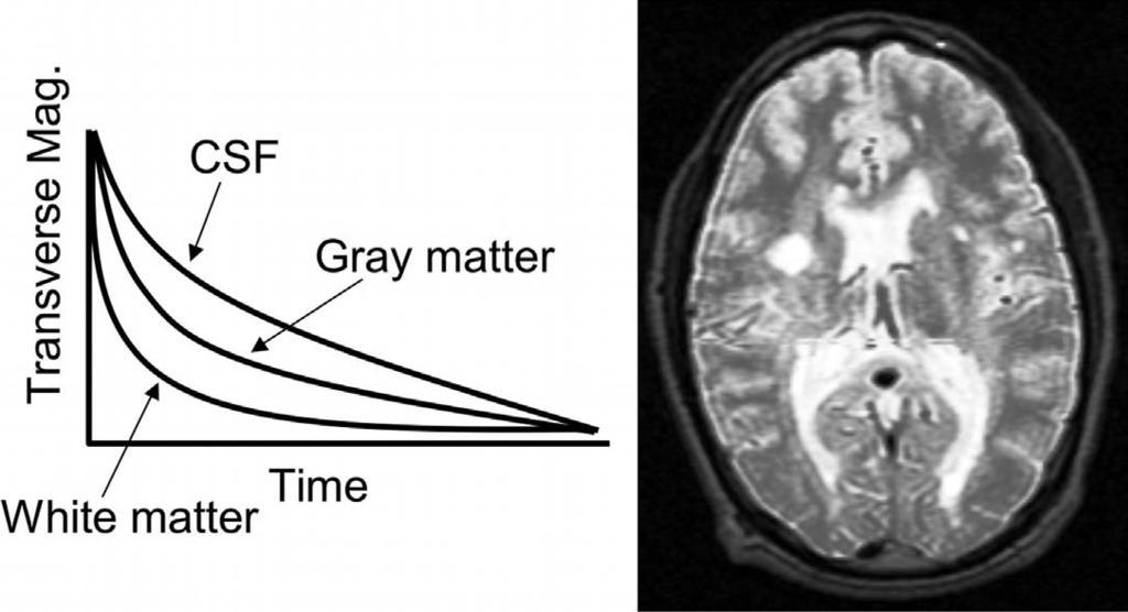 Figure 15. T2-weighted contrast Pooley, R. A.