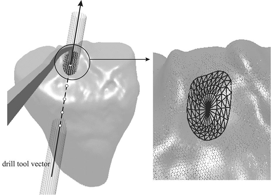 Generisani model golenjače izrađen na Maker- Bot Replicator 2X štampaču (levo) i uveličani prikaz kompeksnog 3D pripoja prednjeg ukrštenog ligamenta na golenjači (desno) transverse (b) and sagittal