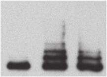 The experiment was performed as in (b), using ubiquitin proteins (Ubi-K48A, Methylated Ubiquitin and Ubi-K7R) that are unable to poly-ubiquitinate.