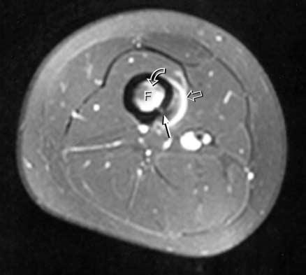 T2-weighted images (Fig.