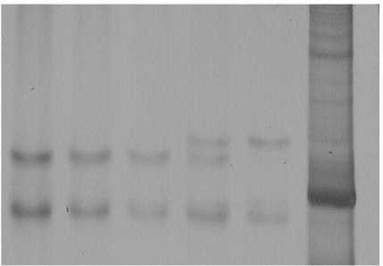 Typical electrophoresis gel showing SSCP analysis of a point mutation From left to right: lanes 1-3 are homozygous
