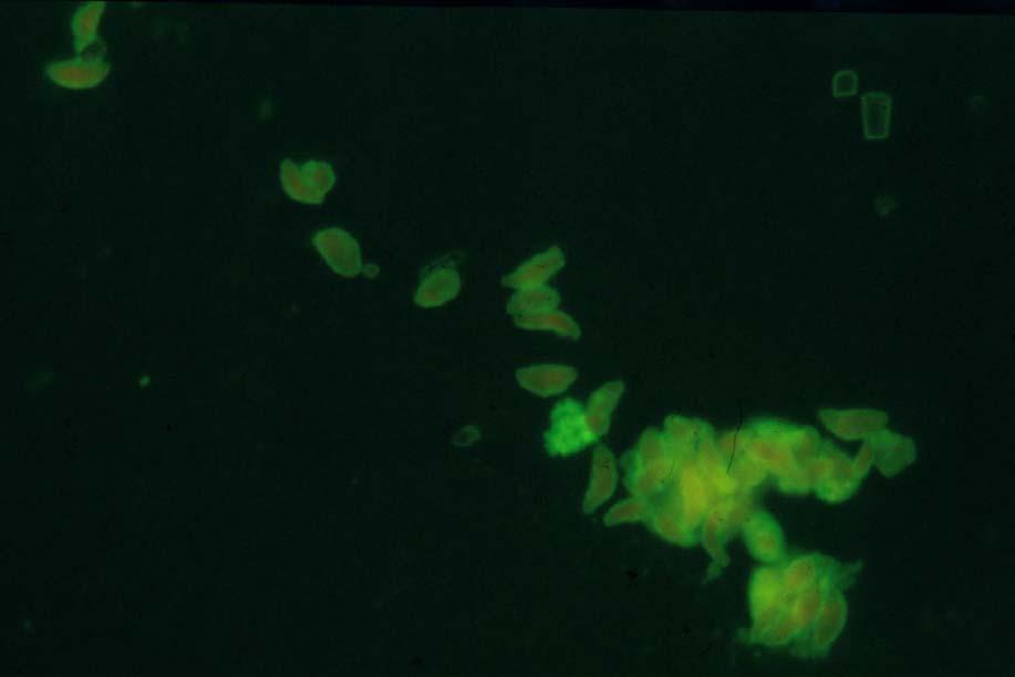 Toxoplasma gondii These trophozoites from ascitic fluid of the mouse were made