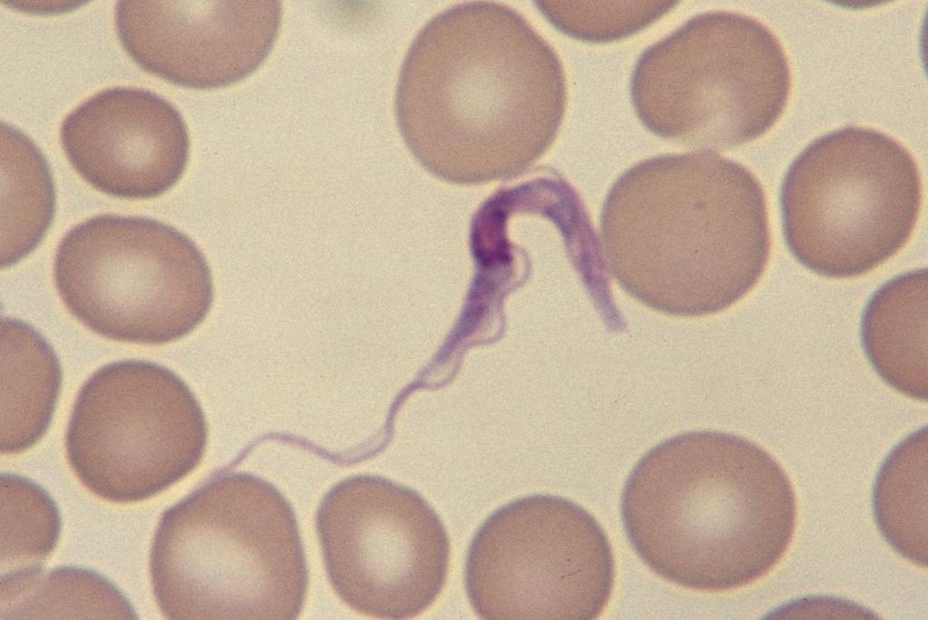 Trypanosoma brucei gambiense Slender form, 30 μm long, with central nucleus, undulating membrane and long free flagellum.