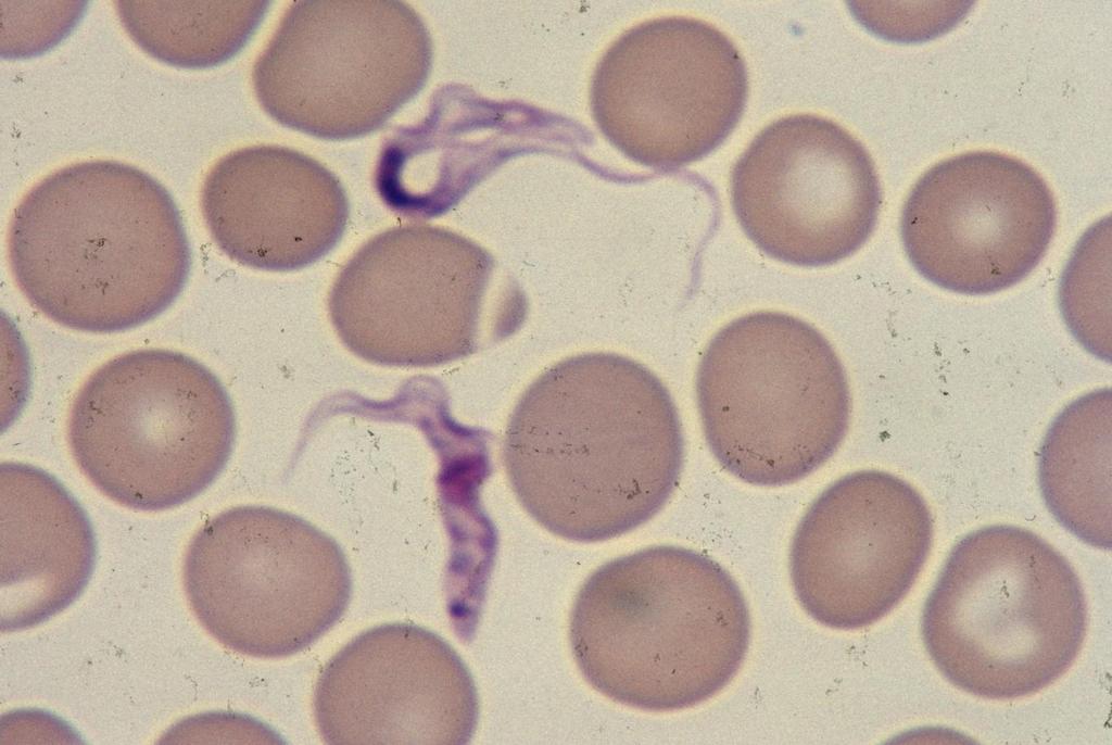 Trypanosoma brucei gambiense Long and short forms.