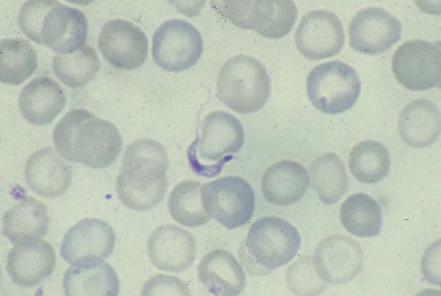 Trypanosoma cruzi It is unusual to find these trypomastigotes in a thin blood smear.