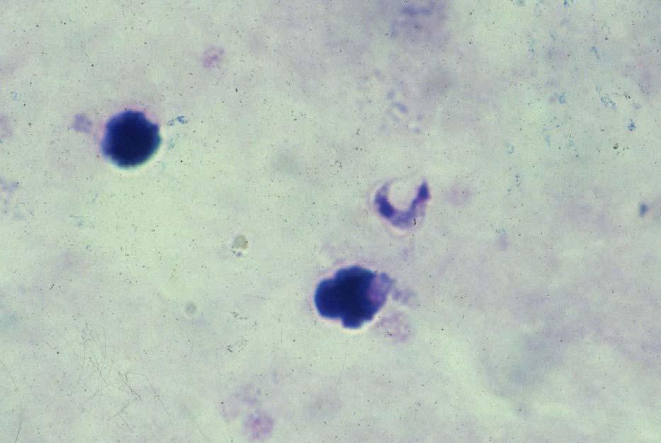Trypanosoma cruzi In a thick blood film these trypanosomes