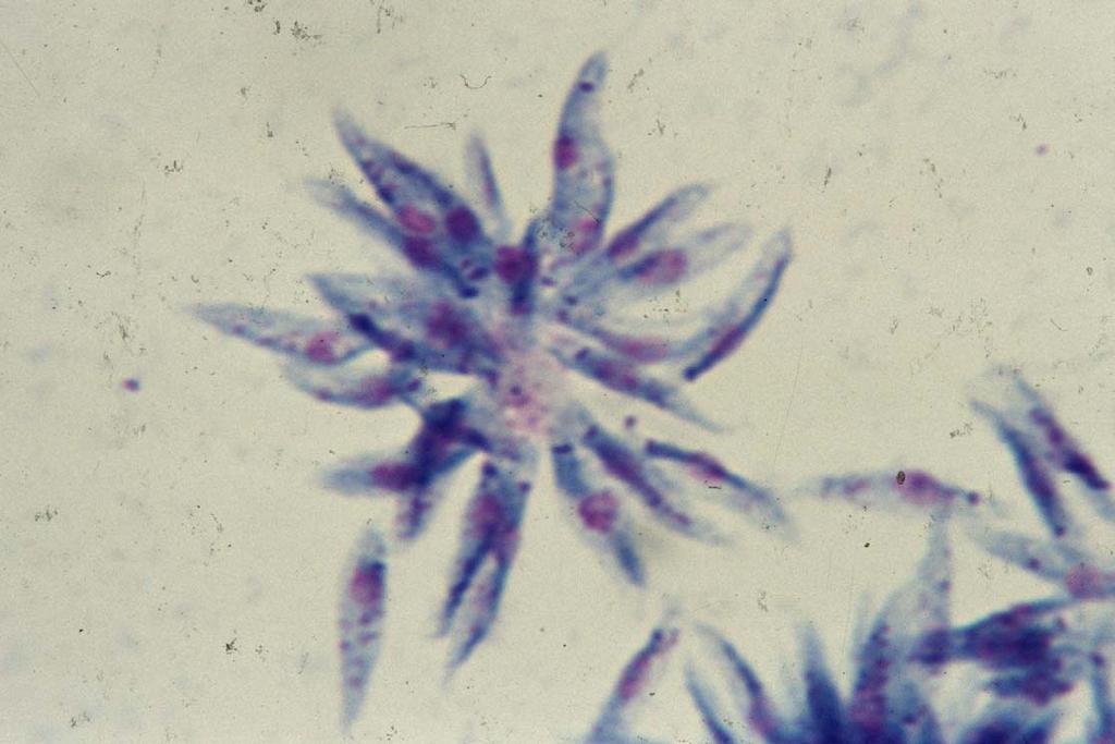 Leishmania tropica Promastigotes (leptomonas) in rosettes in