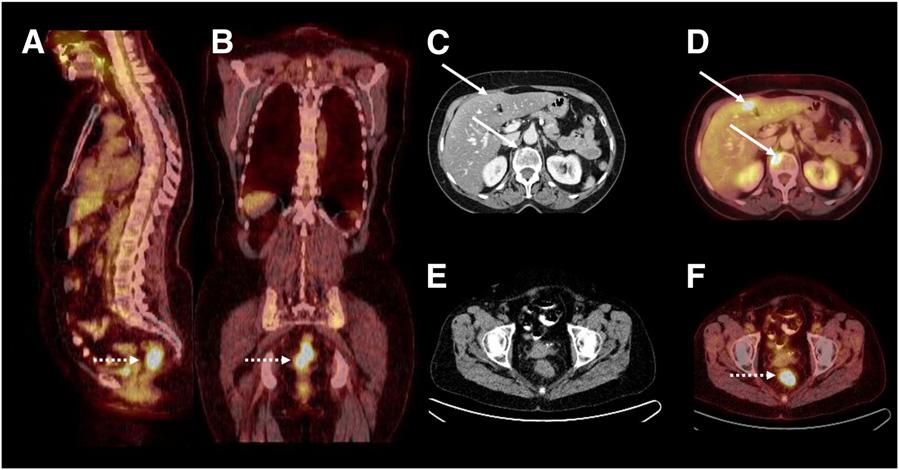 FIGURE 3. PET/CT has greater diagnostic accuracy than separately performed imaging modalities.