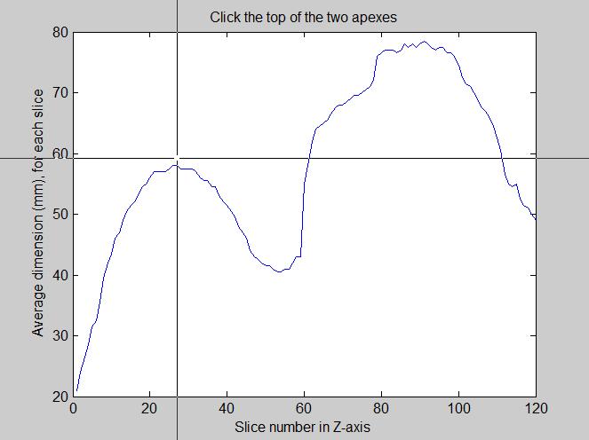 3. MATERIALS AND METHODS 49 Figure 3.6.1.1. Average dimension versus slice number of MRI. The code in the Appendix 5-C asks the user to click the tops of two apexes.