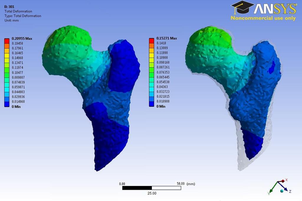 4. RESULTS 52 4.2. Total Deformation Total deformation was also calculated through the FE models. The results show that the cortical bone geometry deformed approximately from 0 to 0.