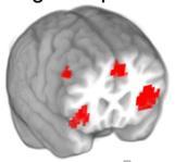 prefrontal cortex/middle frontal gyrus Intraparietal sulcus Inferior parietal lobules Cingulo-opercular intention system