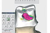 Becoming a Total Solution Provider for tooth replacement