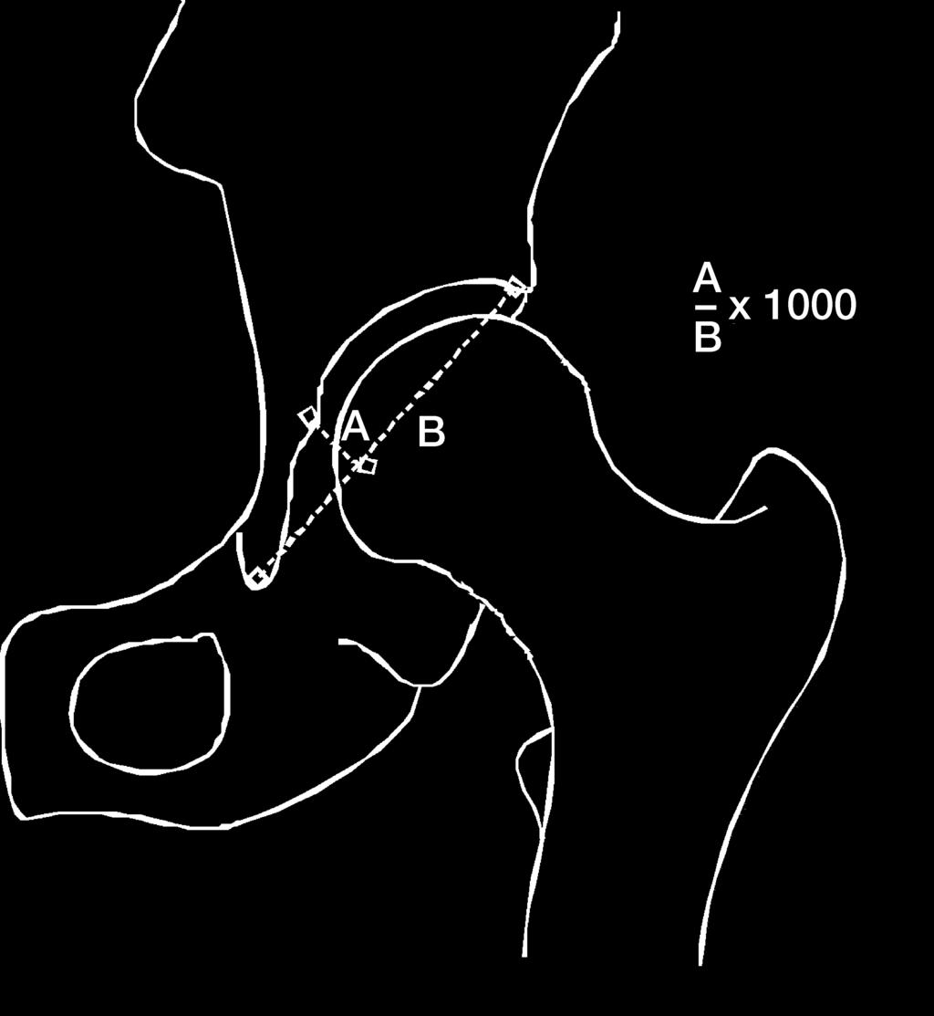 point. Consecutive radiographs were obtained in starting positions and at each 3 increment.
