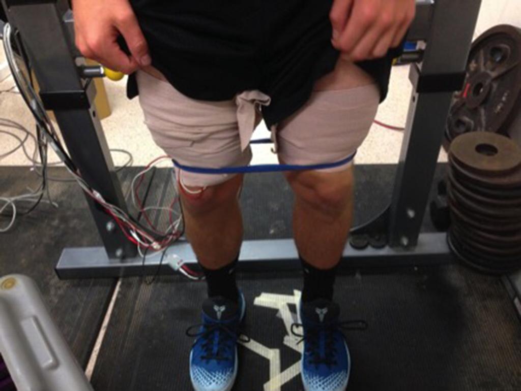 Figure 3. Experimental setup, anterior view. Placement of band and tensor bandage and EMG connected to the right thigh to avoid discomfort and keep electrodes in place.