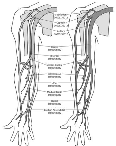Basic Coding Case 23: Bilateral lower extremity venograms from foot or popliteal injec3ons.