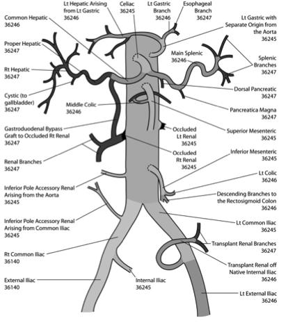 Variant Visceral Arterial Anatomy