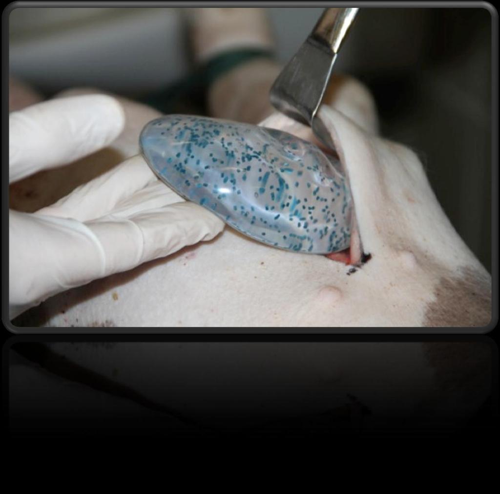 Implantation in porcine cadaver model Breast implant with the contrast particles (blue)