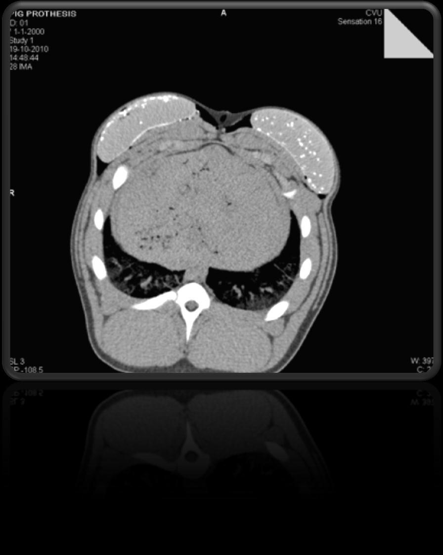 CT MRI Representative plot from CT imaging,