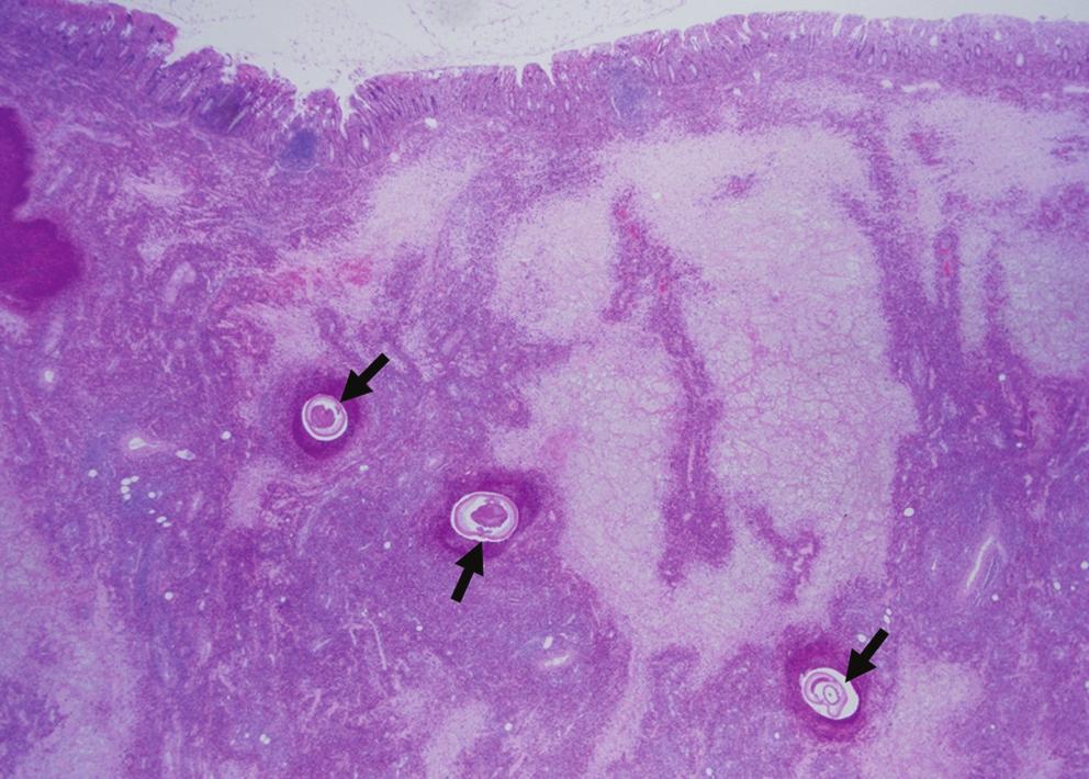 Several parasite worms (arrows) were found within edematous submucosal layer. H. Microscopic photograph (original magnification, 100) of crosssection through intestinal region of nematode.