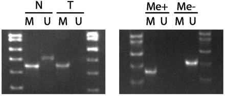 A HNPCC case with hypermethylation of MLH1 two fragments of different lengths containing the same region, 91 and 103 bp long, respectively.
