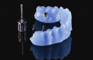 Screw-retained implant-supported restoration in the edentulous maxilla A working document for the production of a milled zirconium dioxide framework Authors: Dr Octavian Fagaras & Milos Miladinov,