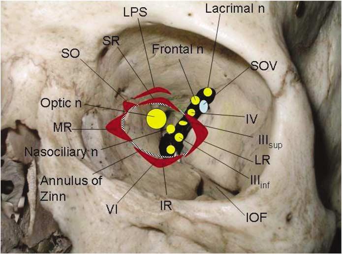 Update on orbital anatomy 1125 Figure 10 Anatomy of the left orbital apex, highlighting the extraocular muscle origins and the contents of the superior orbital fissure.