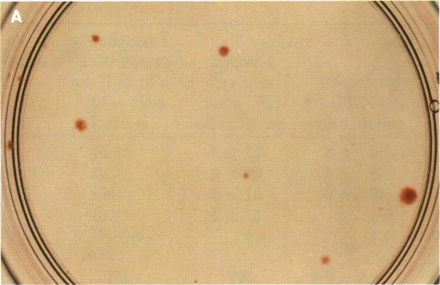 Twenty to 50% of hemoglobin-containing colonies were of demonstrable mixed colony morphology containing erythroid cells, neutrophils, and basophil/mast cells.
