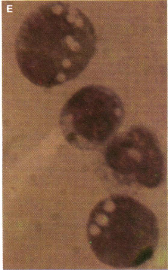 ) (E) Wright/ Giemsa-stained appearance of a single-cell-derived mixed colony from line Ro cl 24 showing eosinophils and neutrophil-granulocytes. (x 1,200.