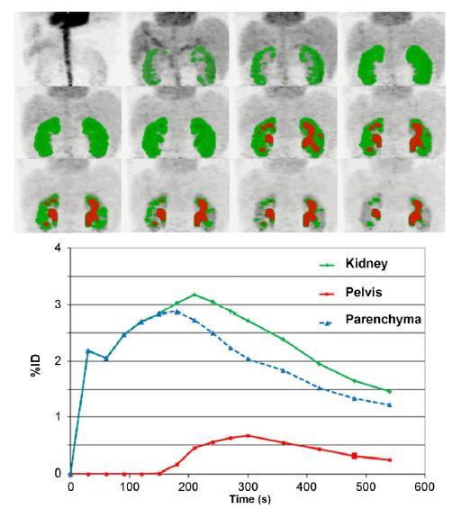 68 Ga-EDTA PET/CT Imaging and Plasma Clearance for Glomerular