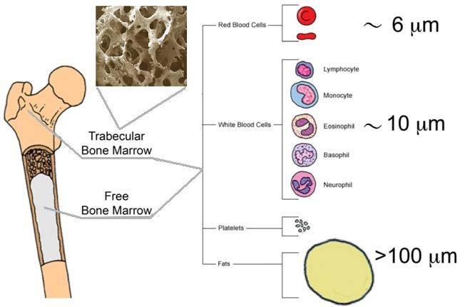Introduction Human cancellous : components and porous structure Osteoporosis = porous